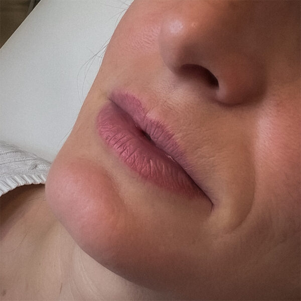 Lippen-VOR23